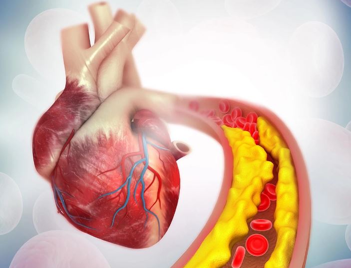 Cholesterol-Treatment