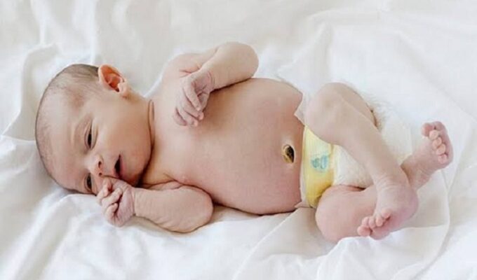 Low birth weight babies