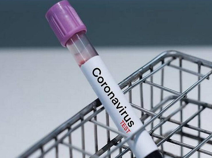CORONA-Virus-Test