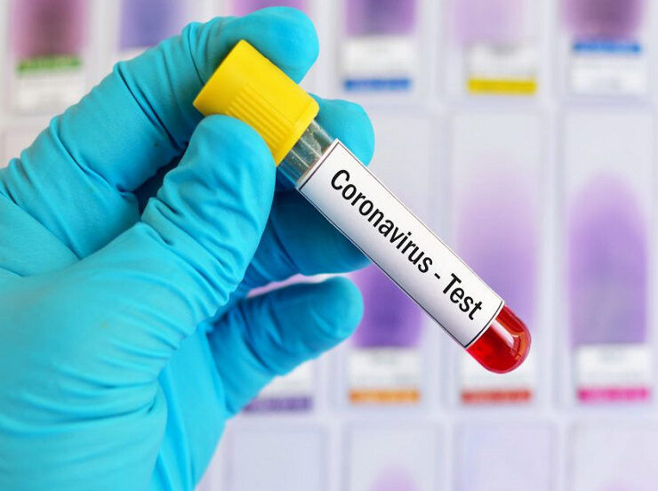 CORONA-Virus-iNDIA-Update