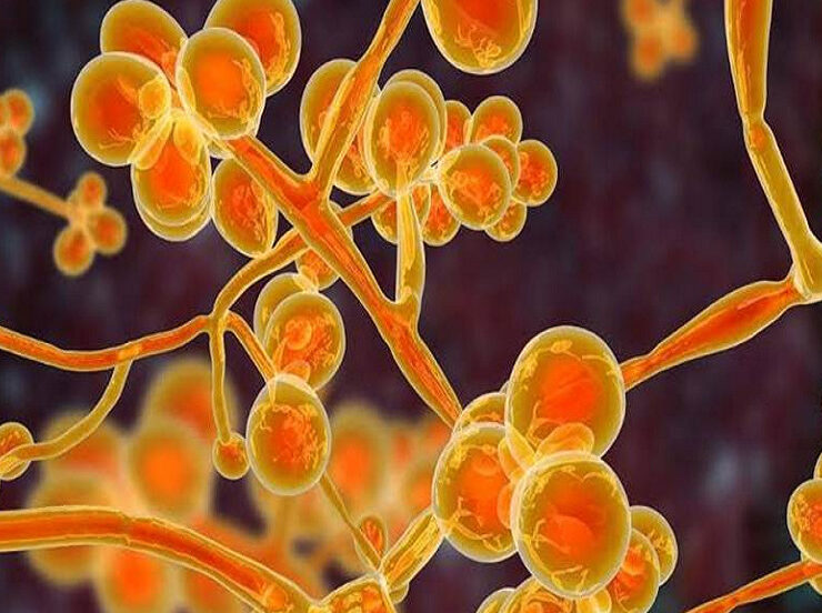 Yellow-Fungas-Symptoms