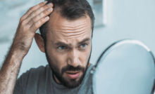 Hair-Problem-in-Hindi