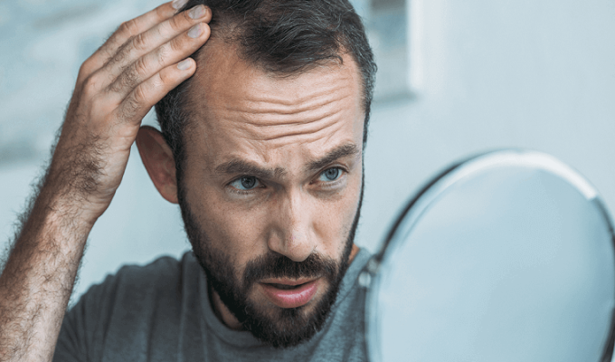 Hair-Problem-in-Hindi